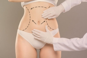 Smooth Recovery After VASER Liposuction: What You Need to Know