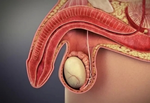 Ayurvedic Treatment for Erectile Dysfunction (ED): Balancing Body, Mind, and Sexual Health