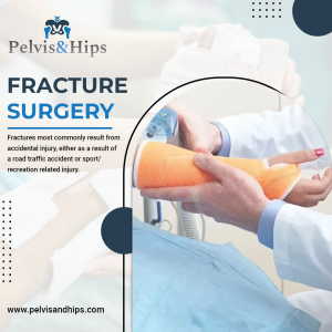 Mr Khitish Mohanty’s Expertise in Fracture Surgery