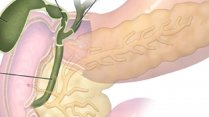 When to See a Gallbladder Specialist in Singapore – Symptoms & Solutions