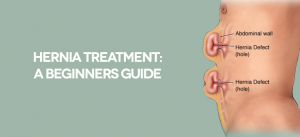 Singapore’s Best Hernia Doctors: Where to Go for Reliable Care