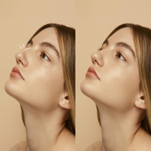 Rhinoplasty Trends in the UAE: What’s New in Nasal Aesthetics?