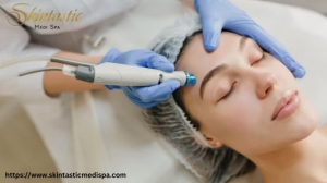 Benefits of a Professional Hydrafacial in Riverside for Smooth Skin