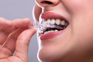 How a Custom Night Guard Can Transform Your Oral Health and Sleep
