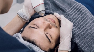 Fractional RF Microneedling: Enhance Your Skin’s Natural Beauty