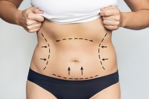 Get Rid of Fat Fast with Liposuction That Works