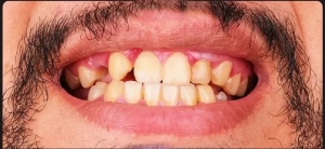 Efficient Ways to Ease Your Anxiety Before Dental Visits