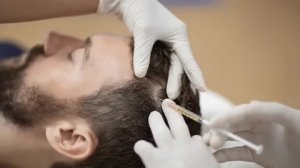 Hair Loss Treatment Market Growth Driven by Innovations