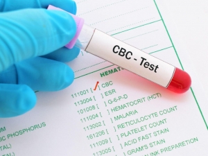 Decode Your Health with CBC Blood Test at Starimaging