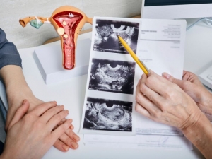 How Your Reproductive Health Affects Your Bones, Brain & Beyond