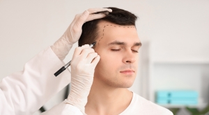 Hair Transplant in Dubai Is the Boost You Didn't Know You Needed