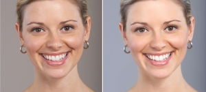 Skin Lightening Treatment in Delhi: Expert Solutions from Medlinks & Top Dermatologists in Gurgaon
