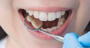 What Procedures Are Involved in Full Mouth Rehab?