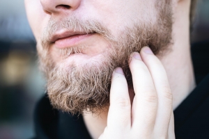 Bald Patches on Beard What It Means & Solutions 