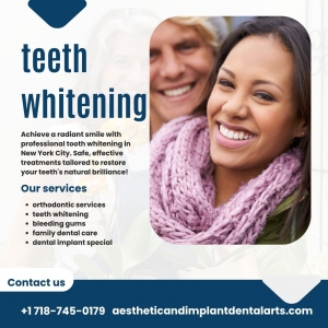 What Are the Different Types of Teeth Whitening Options?