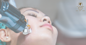 HIFU Face Treatment