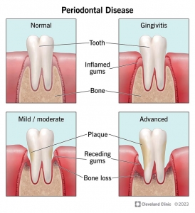 Periodontist in San Antonio TX: Expert Gum Care for Lasting Oral Health