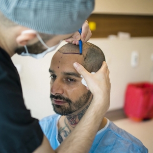 Can stem cells regrow hair?