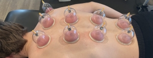 Can Hijama improve skin conditions?