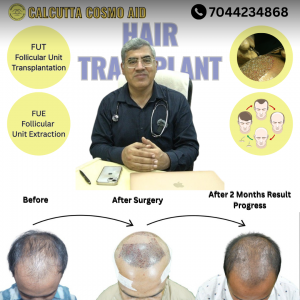Where Hair Grows Back and Hope Returns: The Story of the Cheapest Hair Transplant Clinic in Kolkata