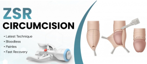 Understanding Circumcision Surgery Cost in Ferozpur and Jagraon: A Comprehensive Guide