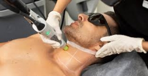 Say Goodbye to Razor Burn: The Magic of Laser Hair Removal