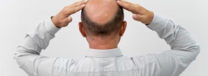 How Do Male Hair Loss Pills Work? A Complete Guide