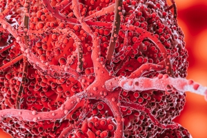 Exploring the Future of the T-Cell Lymphoma Market: Trends, Innovations, and Growth Drivers