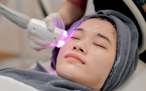 Fractional CO2 Laser: Is It Right for You?