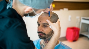 The Hair Confidence Trend Starts with Hair Transplant in Dubai