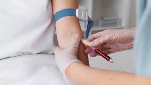 Your Trusted Destination for Affordable Blood Tests near Vikaspuri – Star Imaging