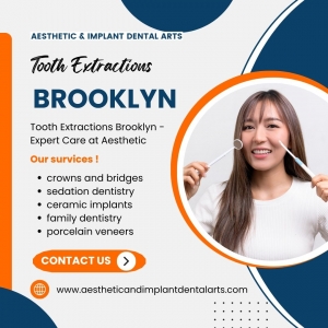 Do I Need a Tooth Extraction? 