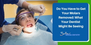 Do You Have to Get Your Molars Removed What Your Dentist Might Be Seeing