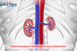 Total Anomalous Pulmonary Venous Connection (TAPVC) in India – Life-Saving Pediatric Cardiac Care
