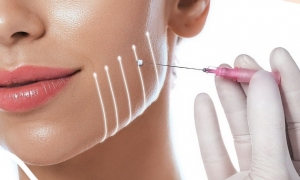 What Makes Islamabad Thread Lift Clinics Different?