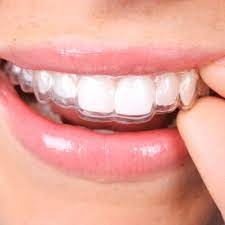 Can Retainers Fix Minor Teeth Shifting?