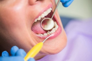 What Happens During a Dental Filling Appointment?