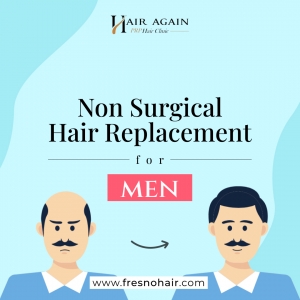 Confidence Without Surgery: Non Surgical Hair Replacement for Men in Fresno