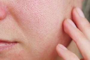 Feel Confident in Your Skin with Pore-Shrinking Solutions in Dubai