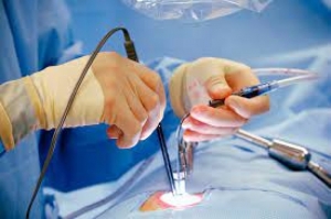 CERTIFICATE IN MINIMAL ACCESS SURGERY - CMAS