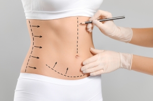 Liposuction Surgery Devices Market Size, Trends, and Growth Analysis 2025-2032