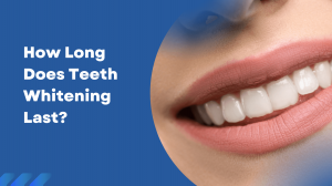 How Long Does Teeth Whitening Last? Tips to Make It Last Longer