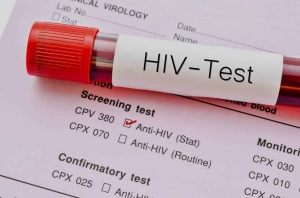 Guide to HIV Testing in Johor Bahru: What You Need to Know