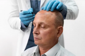 Hair Transplantation Surgery in Bangalore with Dr. Ashok BC