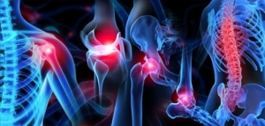 Common Orthopedic Conditions: From Arthritis to Fractures