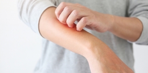 Overview of Acute Bacterial Skin and Skin Structure Infections