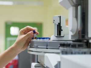 Advancements in High-Performance Liquid Chromatography Techniques for Chemical Analysis