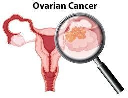 Ovarian Cancer Treatment in India: World-Class Care at Affordable Costs for Women’s Health