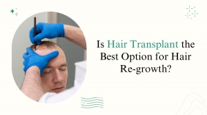 Is Hair Transplant the Best Option for Hair Re-growth?