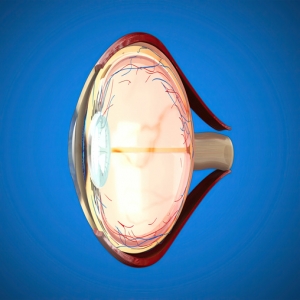 Understanding Glaucoma: Symptoms, Causes, and Treatment